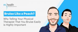 Bruise Easily | Mhealth Blog