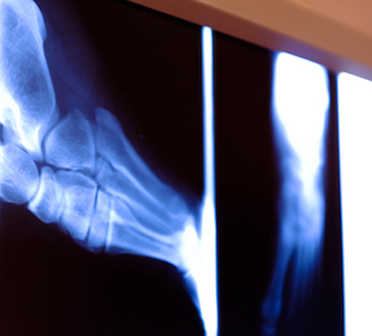 Physiotherapy Cheltenham